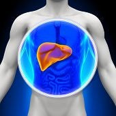 Naturopathic Case study of Fatty Liver